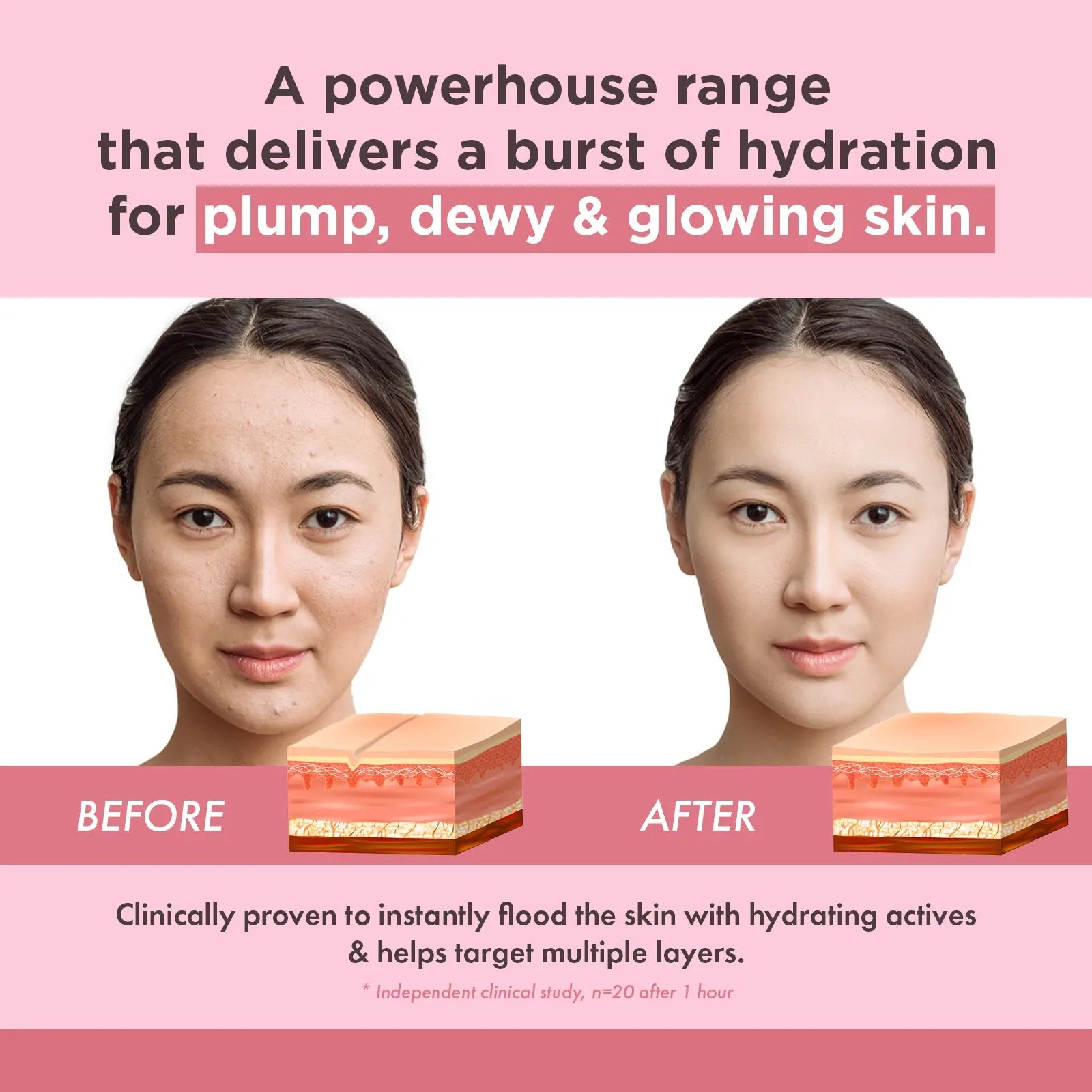 Hydration+ Certified Organic Rosehip Oil 20ml - Essano Singapore-Before-After